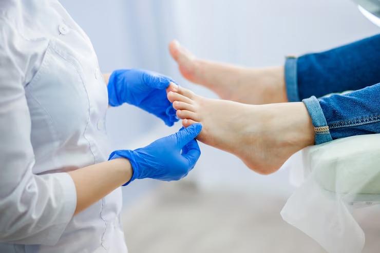 Nagler Foot Center Houston Addresses Growing Demand for Bunion Surgery in Houston