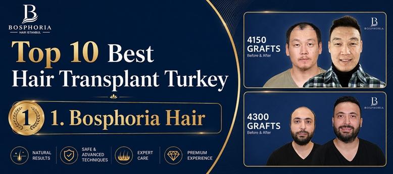 Top 10 Hair Transplant Clinics in Turkey: 2026 Rankings Highlight Leading Options for International Patients