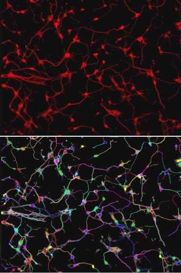 The image above shows nerve cells and the regarding network. HALCON clearly determines these structures. Images: MVTec