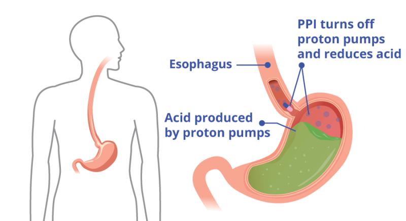 Proton Pump Inhibitors Market