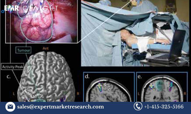 Neuronavigation Systems Market