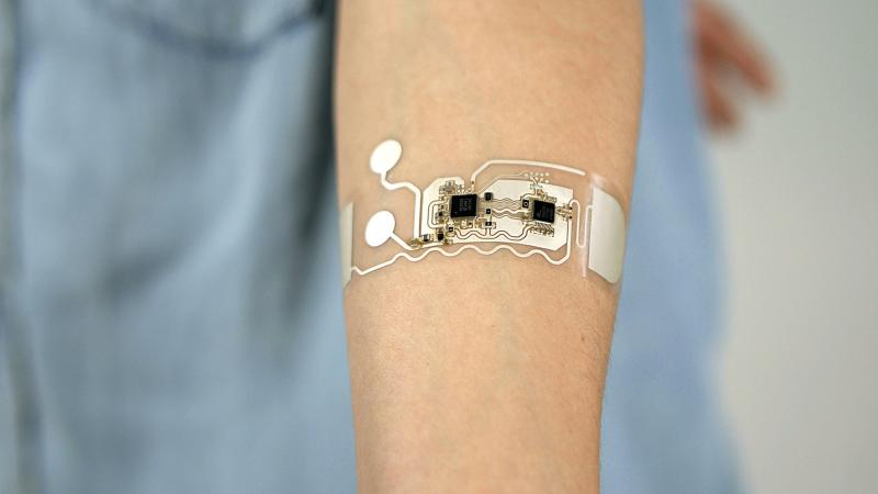 Monitoring Patches Market is anticipated to expand at a CAGR of +15% by 2030 | BioIntelliSence, iRhythm Technologies, BioTelemetry
