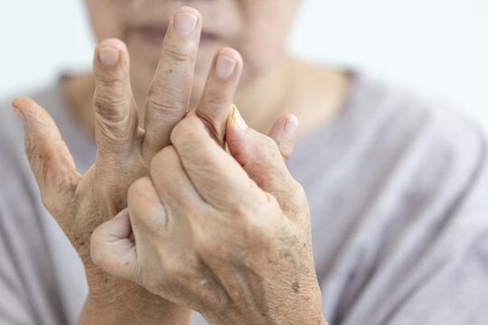 Rheumatoid Arthritis Market