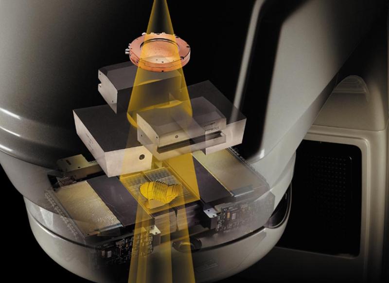 Image Guided Radiotherapy Market