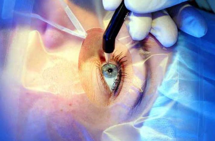 Eye Care Surgical Market