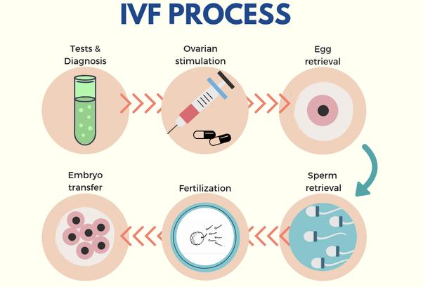 IVF EUROPE