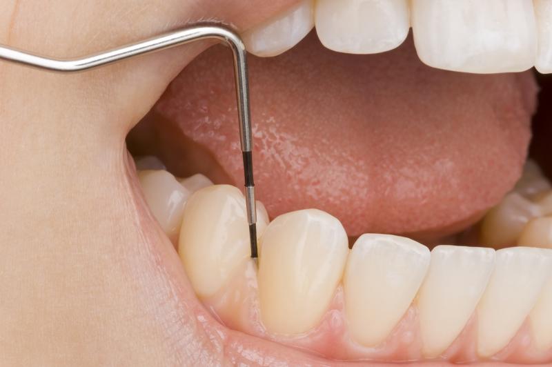Periodontal Treatment Market Outlook 2031 Foresees Growth