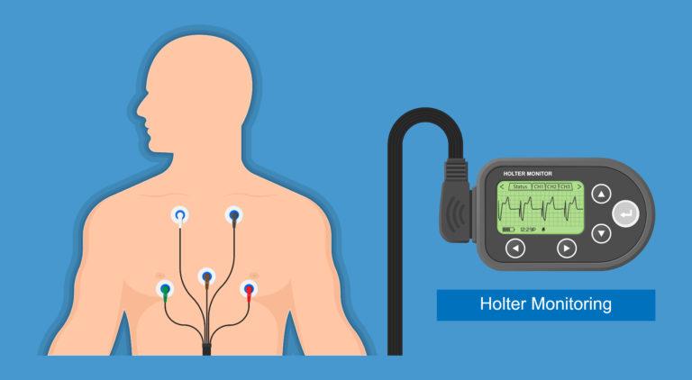 Holter Monitoring System Market