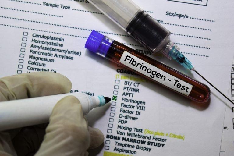 Fibrinogen Testing Market