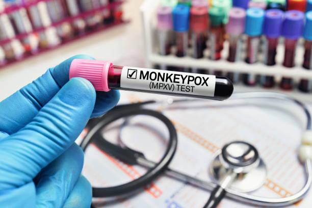 Monkeypox Disease Diagnostics Market Research Report: