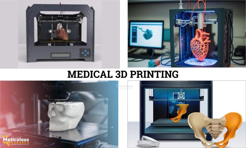Medical 3D Printing Market Set to Surge to $9.6 Billion by 2030, Reveals Meticulous Research®