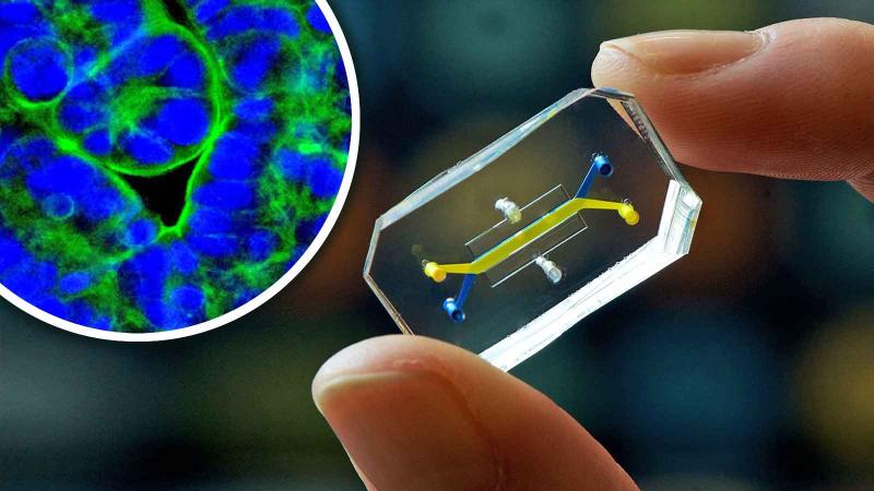 Organ-On-Chip Market