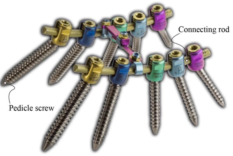 Pedicle Screw Rod System Market to Witness Stunning Growth |Depuy Synthes(Johnson & Johnson), Zimmer Biomet, Globus Medical