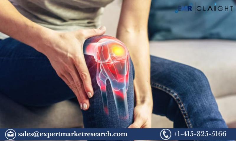 Arthralgia Management Market Size, Share, Price, Trends, Growth, Analysis, Report and Forecast 2024-2032
