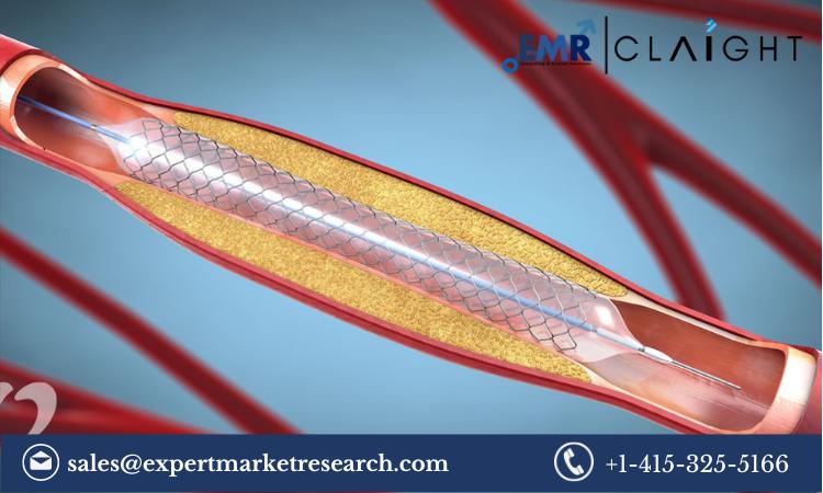 Stents Market Share, Size, Trends, Report and Forecast
