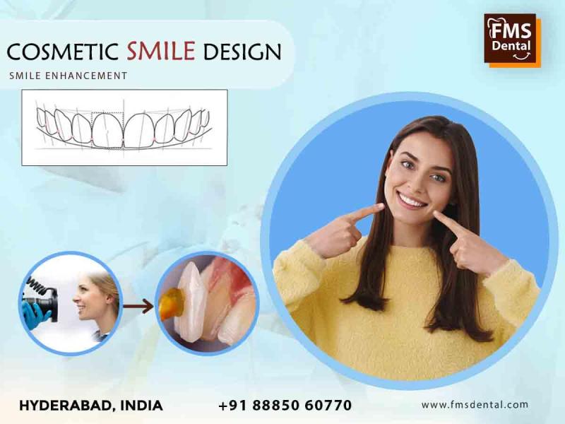 Cosmetic Dentistry: Smile Enhancement Procedures | FMS