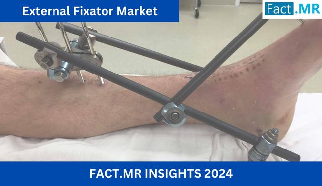 External Fixator Market