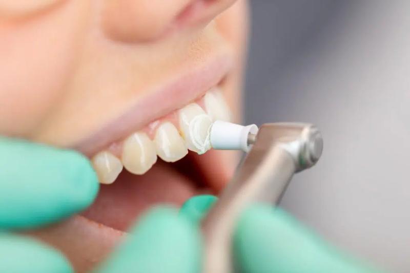 Teeth Whitening Market Projected to Reach USD 10.5 Billion by 2030, States Industry Report