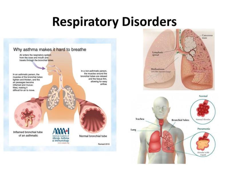 Respiratory Disorders Treatment Market Anticipated to Grow at
