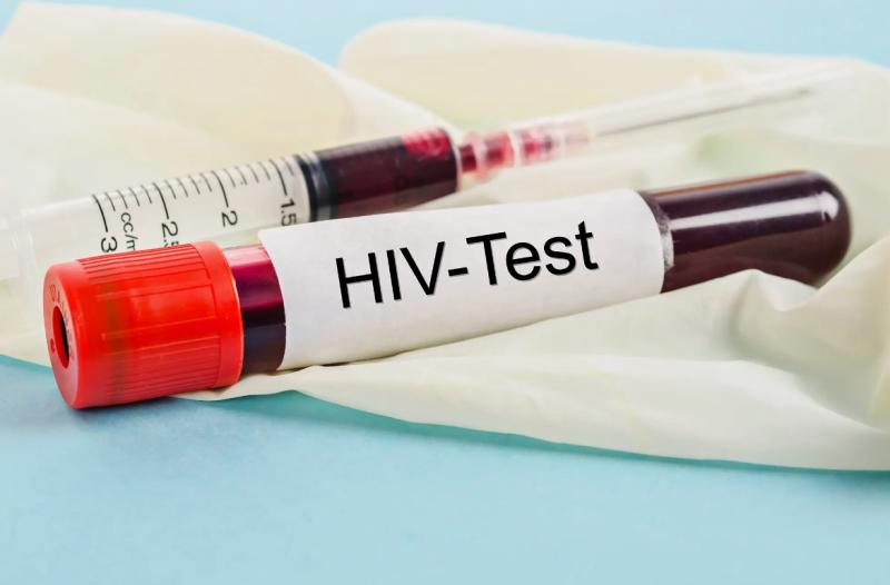 HIV/AIDS Diagnostics