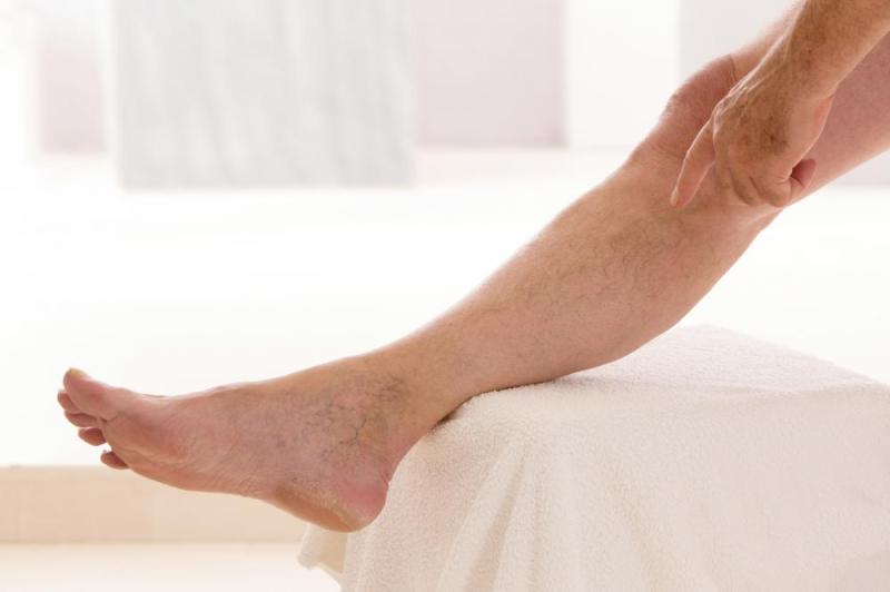 Venous Skin Ulcer Treatment Market