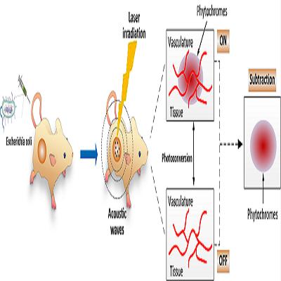 Photoacoustic Imaging Market