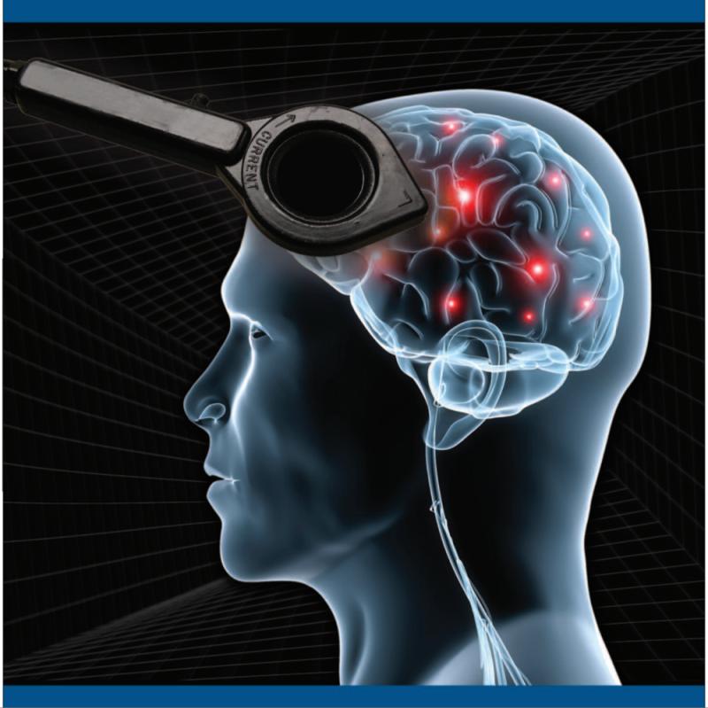 Non-invasive Brain Stimulation System Market