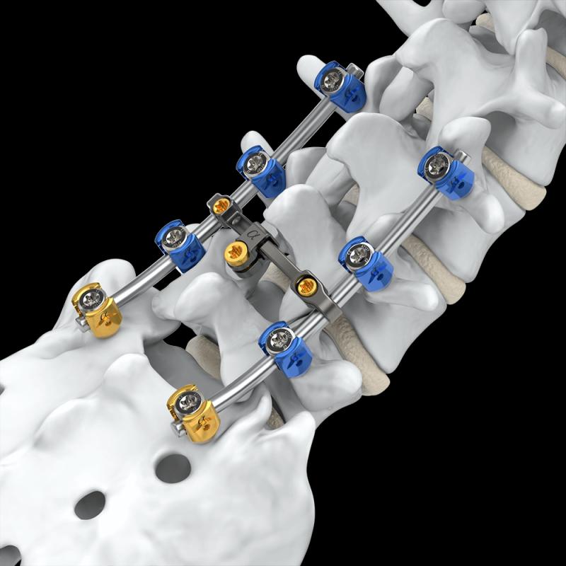 Spinal Implants Market