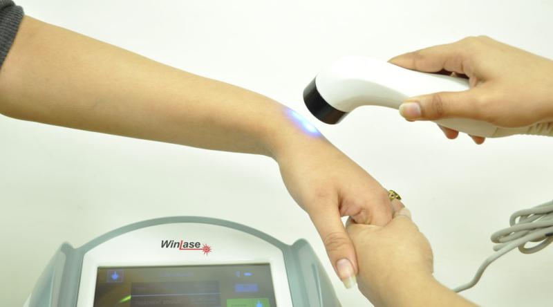 Cold Laser Therapy Market Size is Expected to Reach US$ 134