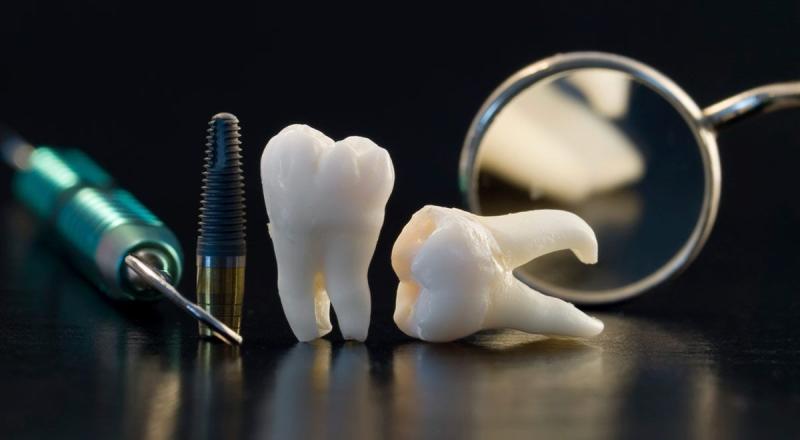 Digital Dentistry Materials & Systems Market