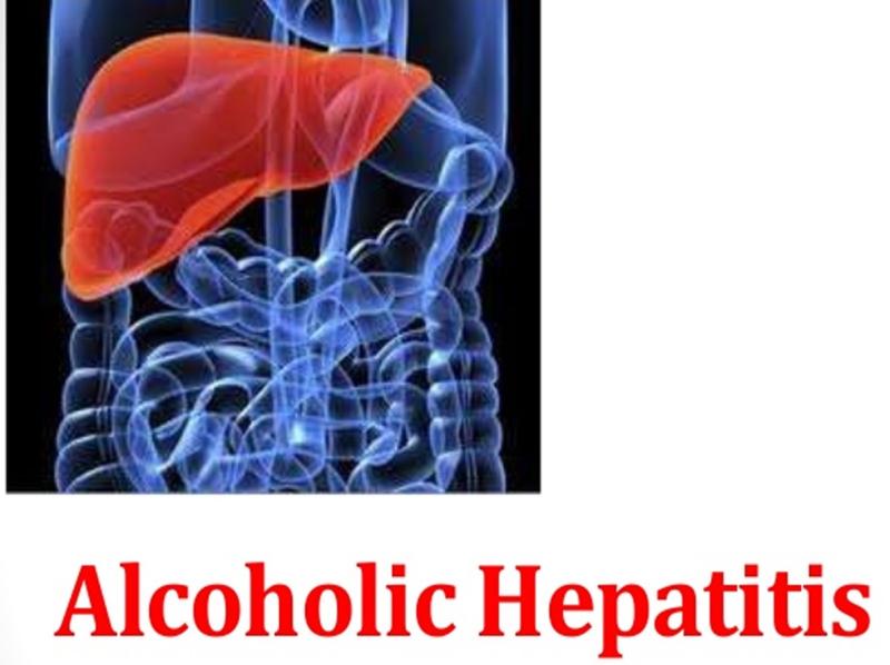 Alcoholic Hepatitis Treatment Market