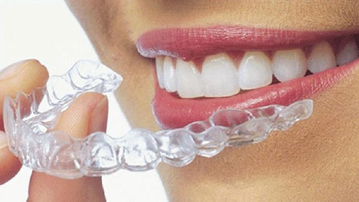 Clear Aligners Market