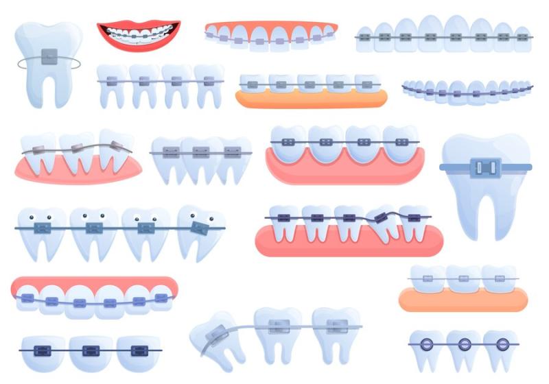 Global Ceramic Brackets Market was valued at US$663 million in 2024 and is projected to reach US$1024 million by 2033.