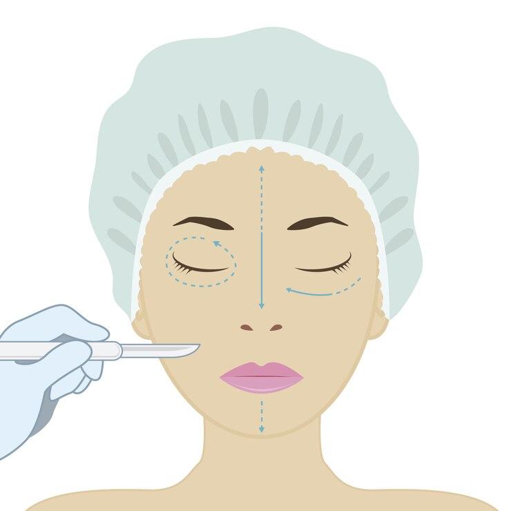 The Global Dermal Curette Market was valued at US$222 million in 2024 and is projected to reach US$429 million by 2033.