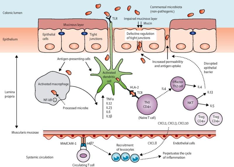 Ulcerative Colitis Immunology Drugs