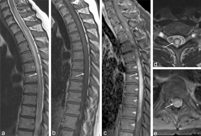 Global Spinal Imaging Market