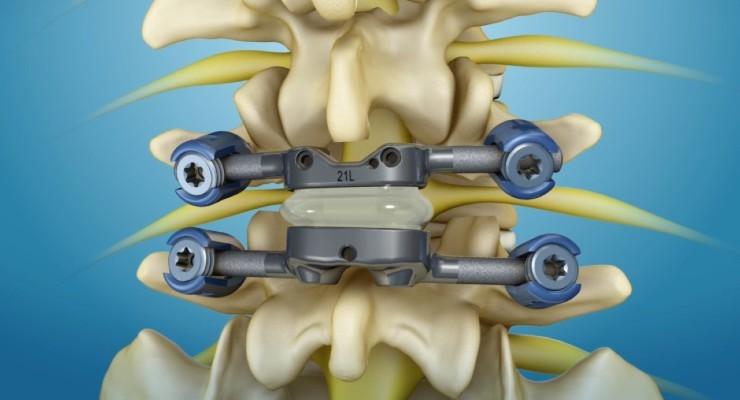 Spinal Implants and Surgery Devices Market