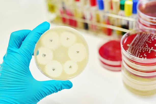 Antimicrobial Susceptibility Testing Market Expected