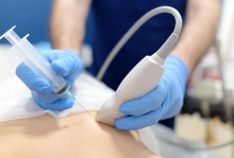 Chronic Pain Solutions Compared: Radiofrequency Ablation vs.