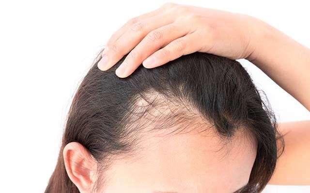 Hair Loss Prevention Product Market