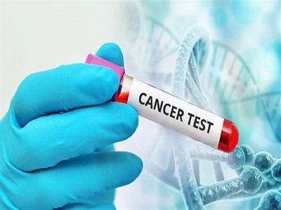 Cancer Test Market