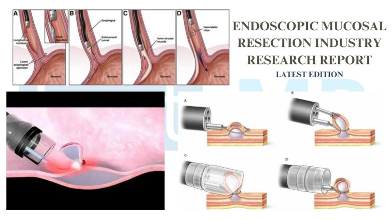 Endoscopic Mucosal Resection Market