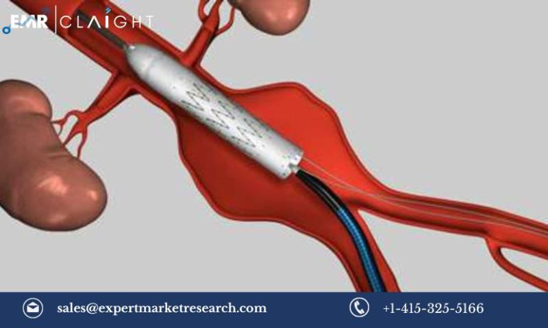 Asia Pacific Aortic Stent Graft Market Regional Analysis and Future Outlook | 2032