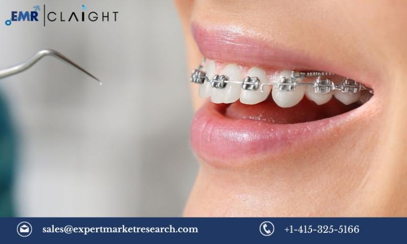 Orthodontic Products Market Size, Share, Trends, Growth,