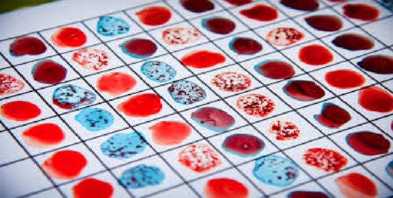 Blood Typing Market