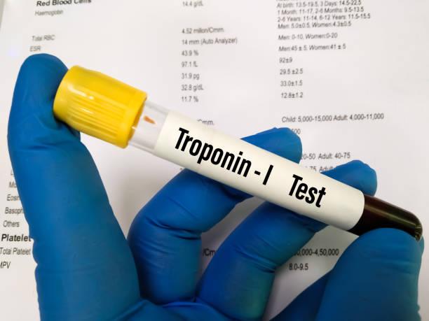 Troponin Market Booming Growth, Challenges Potential Benefits