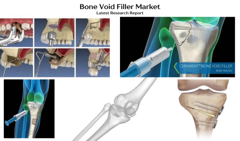 Bone Void Filler Market