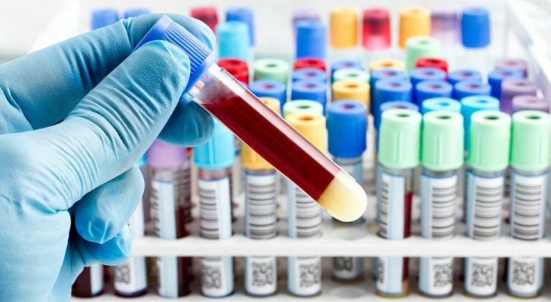 Liquid Biopsy