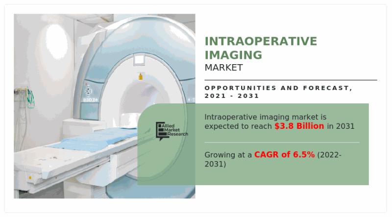 Intraoperative Imaging Market, by Type (Intraoperative Ultrasound, Intraoperative CT, Intraoperative MRI, Others): Global Opportun