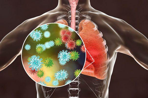 Severe Acute Respiratory Syndrome (SARS) Treatment Market Set